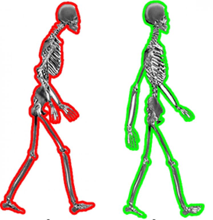 Posture