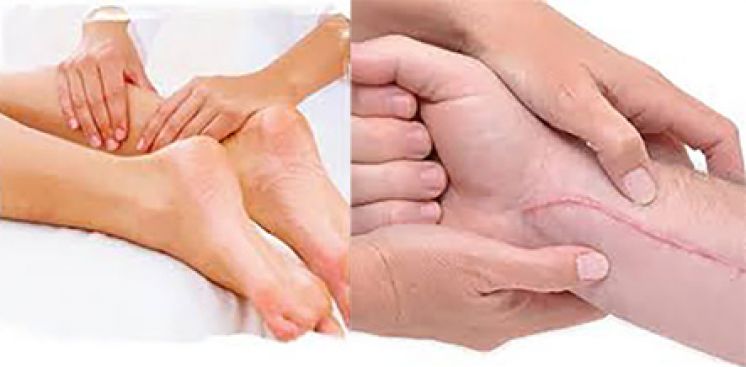 The Benefits of Massage on Scar Tissue